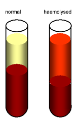 haemolysed